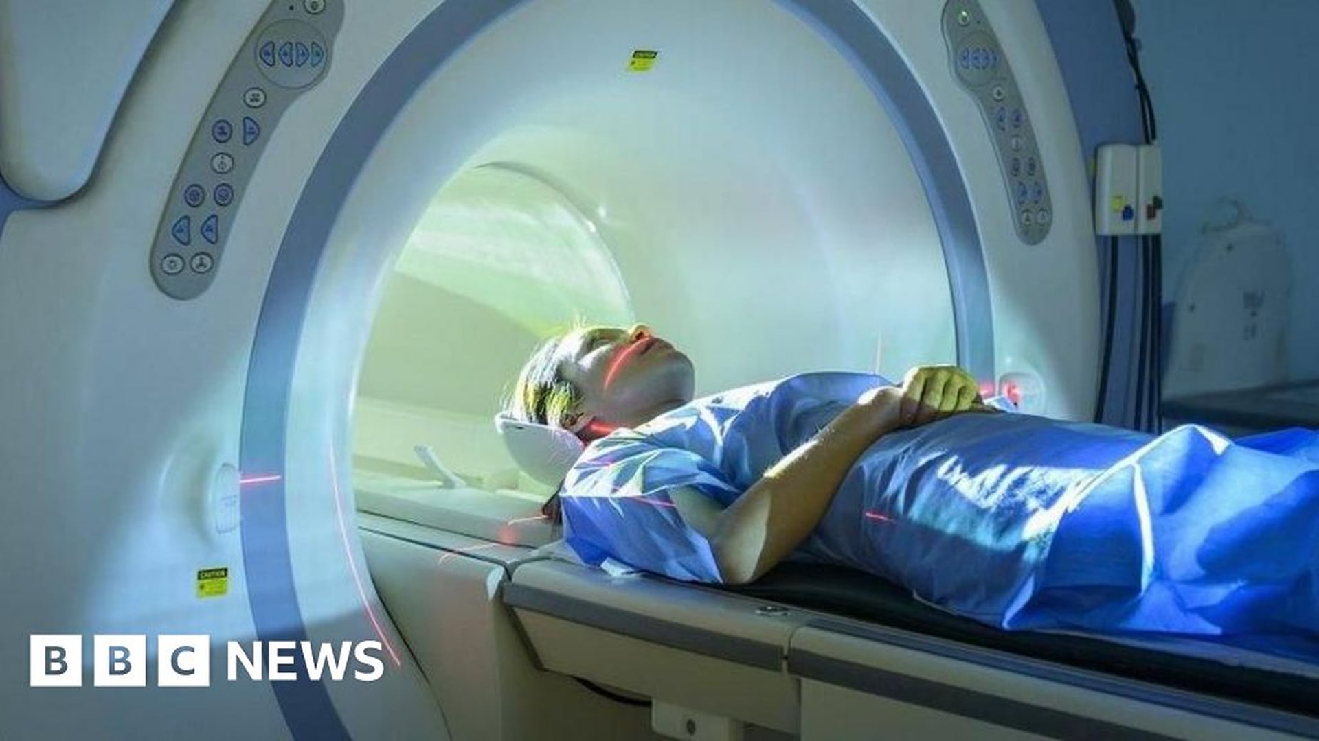 Global Healthcare Strain Fuels Private Sector Reliance, Watchdog Warns of Two-Tier System