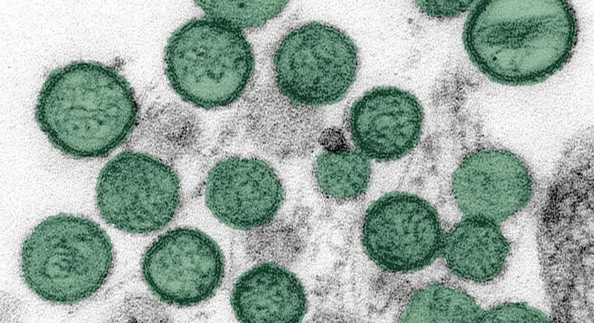 Hantavirus Outbreak on Cruise Liner: Global Health Alert Intensifies with New Case