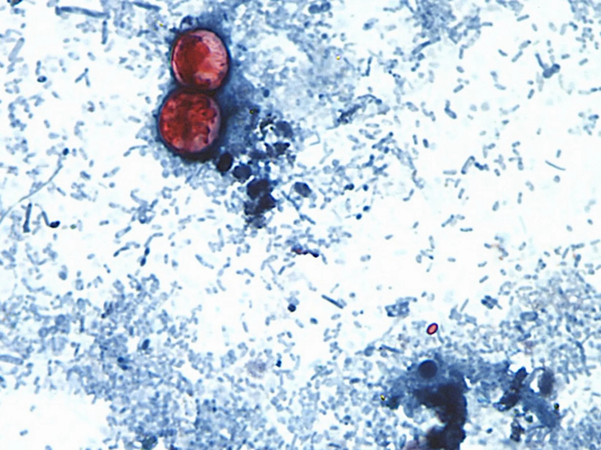 Global Health and Education Watch: US announces first two deaths from cyclospora outbreak