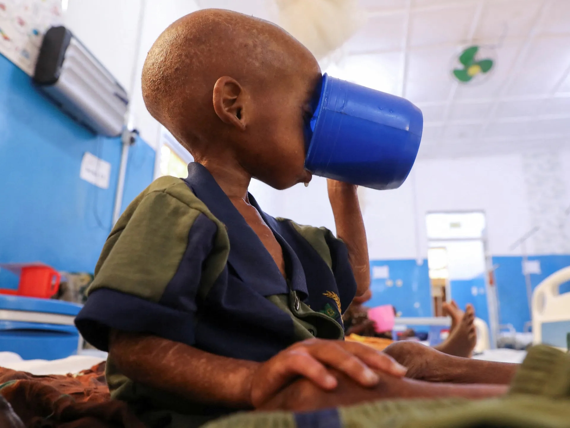 Global Health and Education Watch: Somalia child hunger crisis deepens after aid cuts, UNICEF